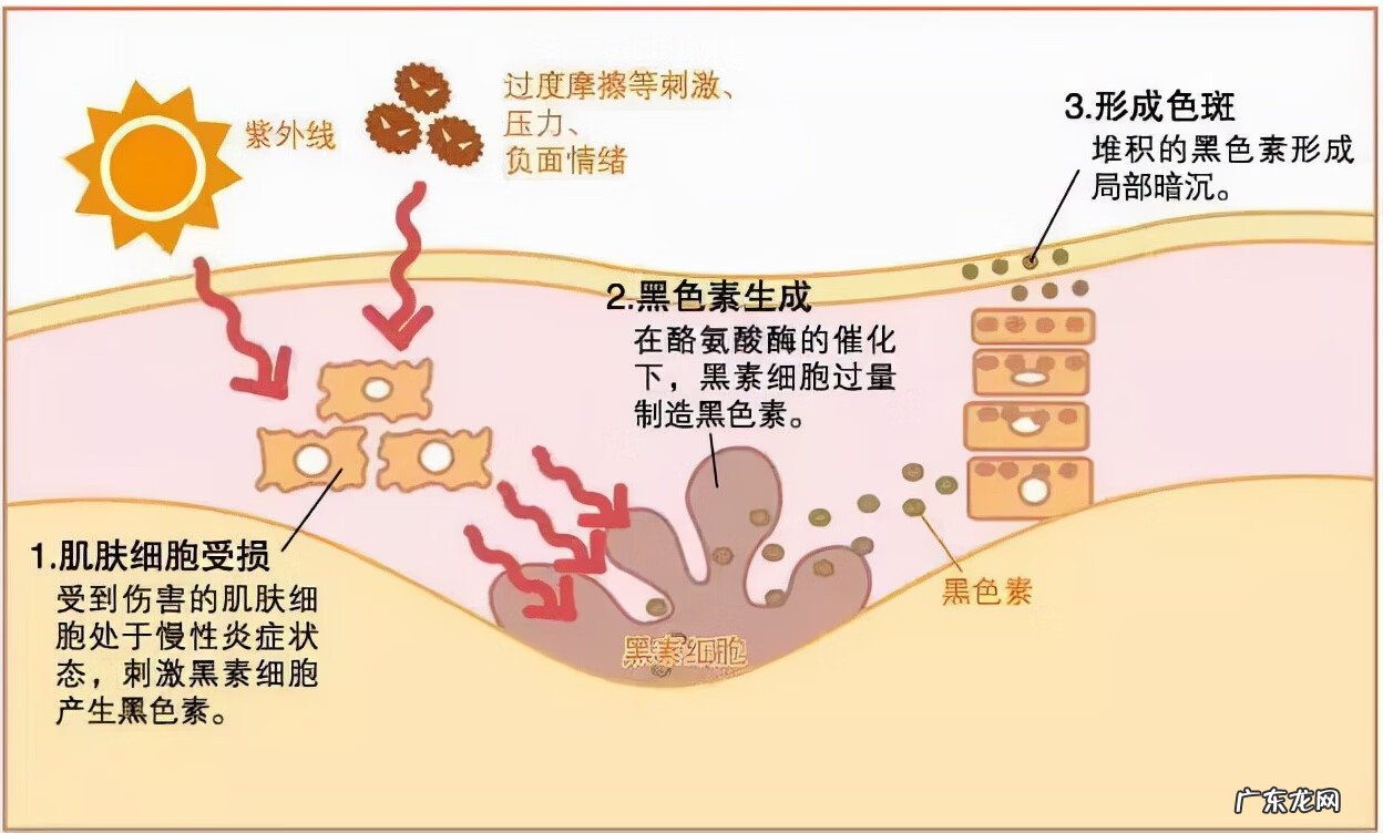 眼下皱纹怎么去除最有效 皱纹怎么去除最快