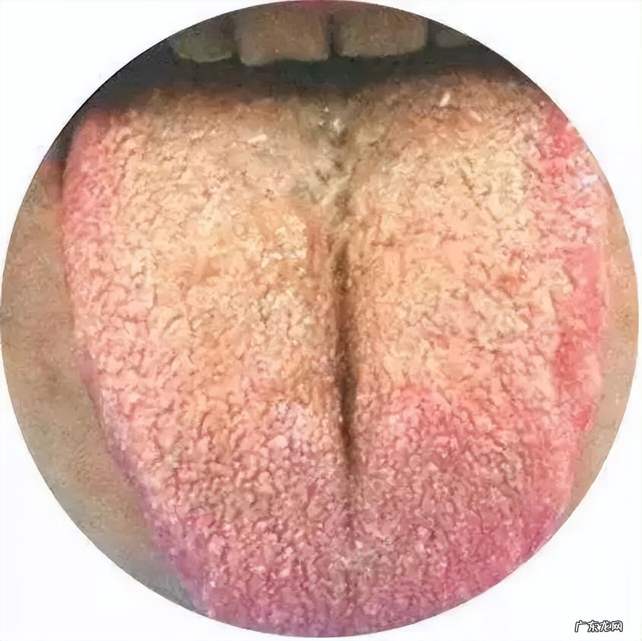 吐痰有什么坏处风水 痰多是哪里不好