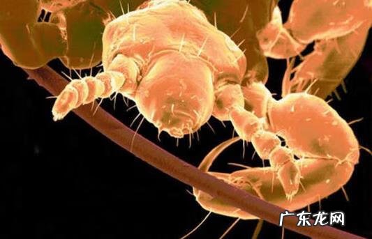 阴虱卵怎么有效清除 阴虱卵怎么消除