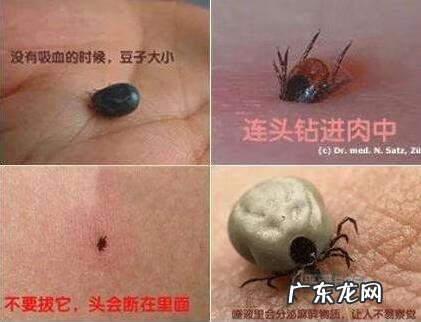 阴虱卵怎么有效清除 阴虱卵怎么消除