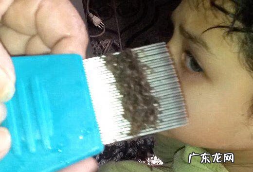 阴虱卵怎么有效清除 阴虱卵怎么消除