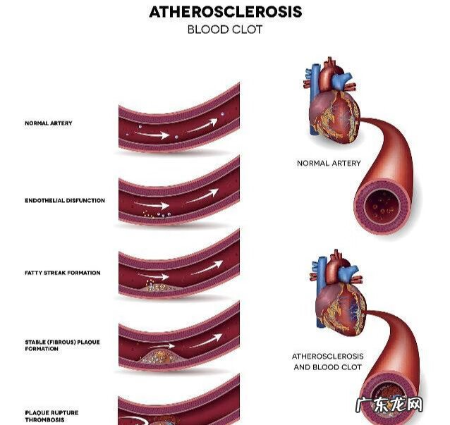 老人便秘吃什么食物 老年人便秘吃什么食物
