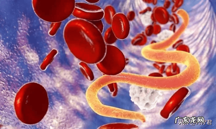 为什么肚子里有蛔虫 肚子有蛔虫是什么感觉