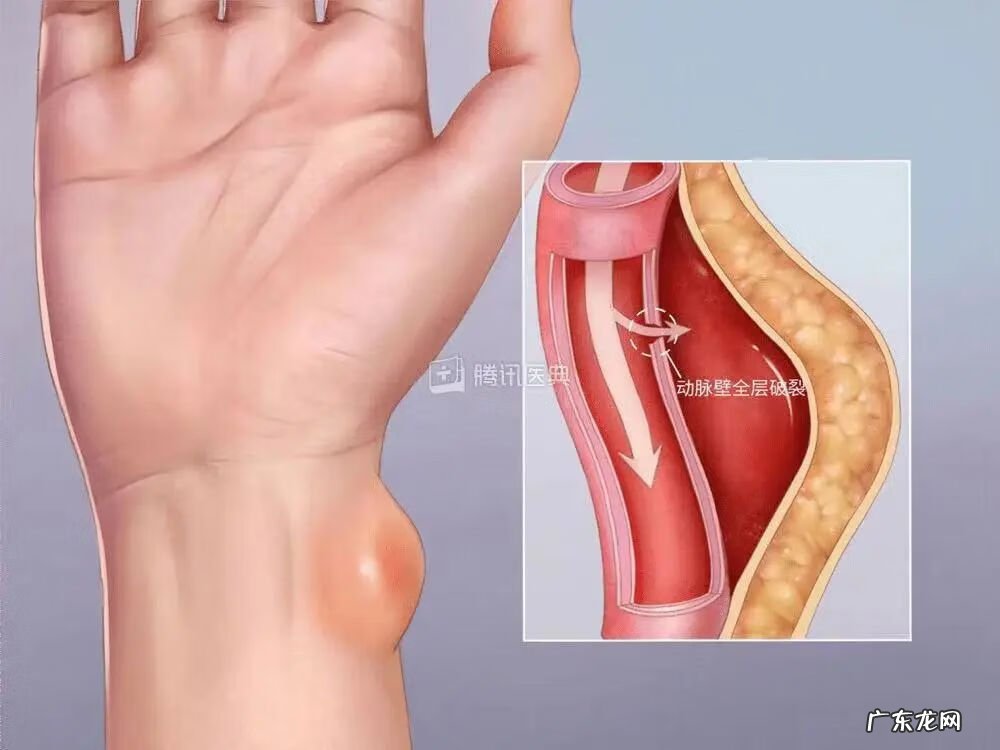 为什么上完厕所会擦出血 突然上厕所拉血怎么回事