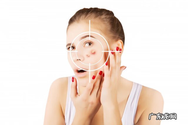 什么能治痘痘 治痘痘的好方法