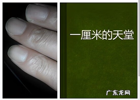 肾结石的症状是什么样的 肾结石都有些什么症状