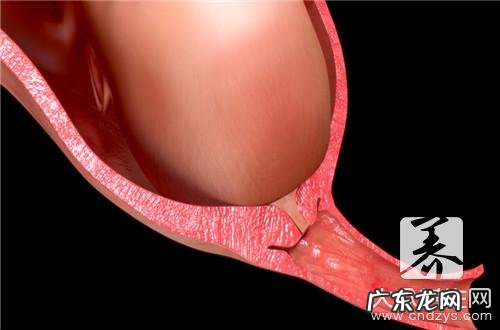 阴囊下垂怎么办 阴囊下垂是什么原因