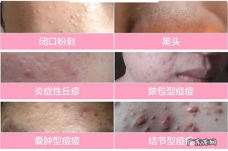 养生歌诀 四季养生歌出处