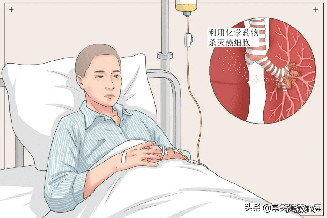 化疗后怎么吃最好 化疗后吃什么最好?