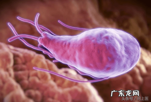 十大寄生虫病 寄生虫病症状