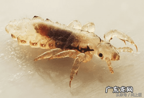 十大寄生虫病 寄生虫病症状