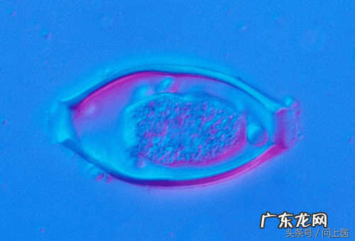 十大寄生虫病 寄生虫病症状