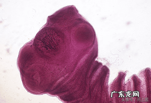 十大寄生虫病 寄生虫病症状