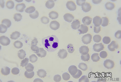 十大寄生虫病 寄生虫病症状