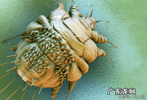 十大寄生虫病 寄生虫病症状