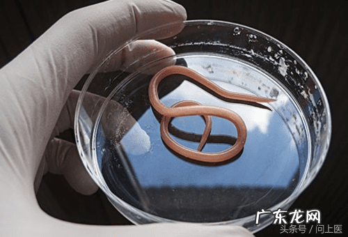 十大寄生虫病 寄生虫病症状