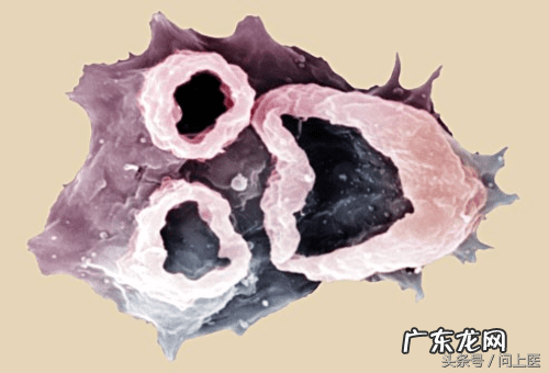 十大寄生虫病 寄生虫病症状