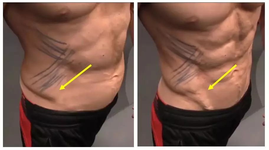 怎么才能让腰部变瘦 怎样瘦腰部的肉