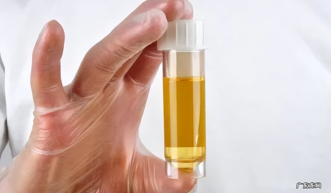 小便严重发黄是什么原因 最近小便黄是什么原因引起的