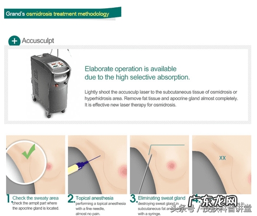 五种教你判断自己是否有狐臭 腋臭怎么治疗更好