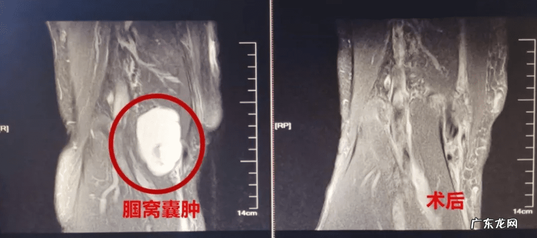 穿衣镜玻璃破了能换吗 破了的镜子怎么修好