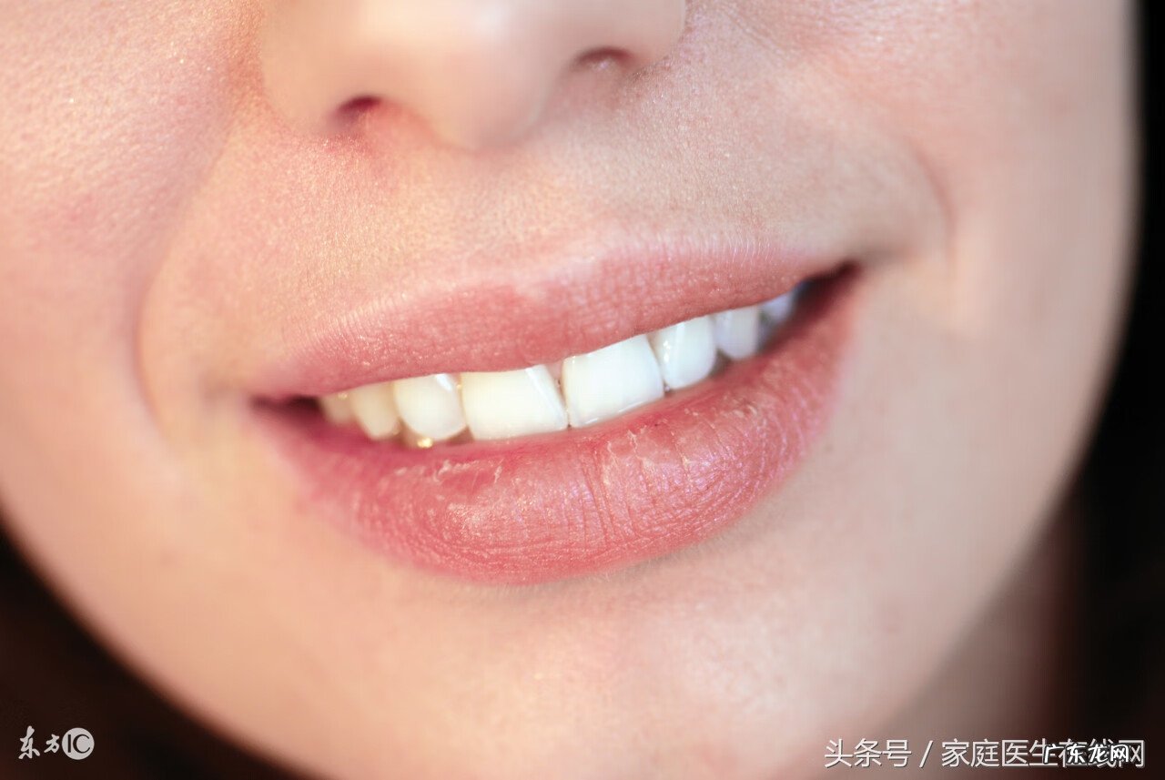 七种水果降火最快 嘴巴上火吃什么水果去火