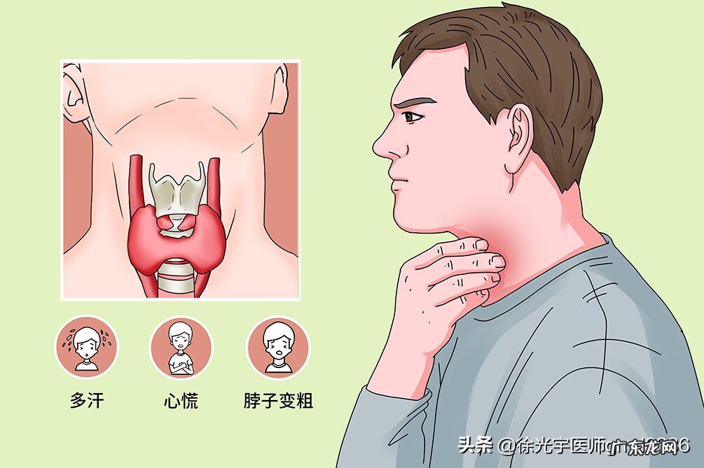 甲亢通俗的讲是什么意思 什么是甲亢病