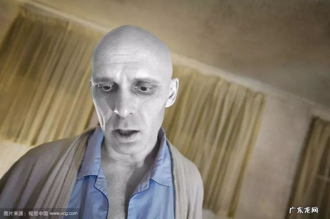 脱发原因应该做什么检查 脱发原因有哪些