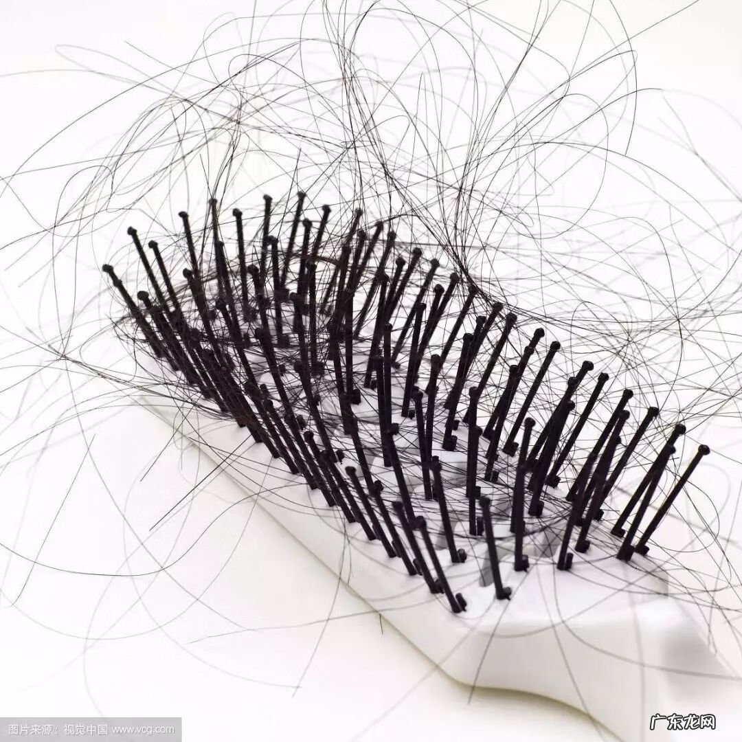 脱发原因应该做什么检查 脱发原因有哪些