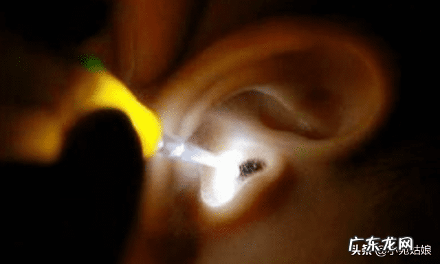 风水与耳朵的案例 耳朵里有虫子是什么症状