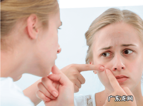 最近脸上老是长痘痘怎么办 脸上长痘痘要怎么办呢