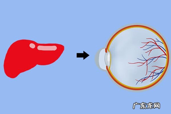眼珠发黄是怎么回事怎么解决
