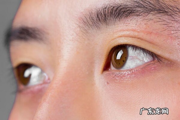 眼珠发黄是怎么回事怎么解决