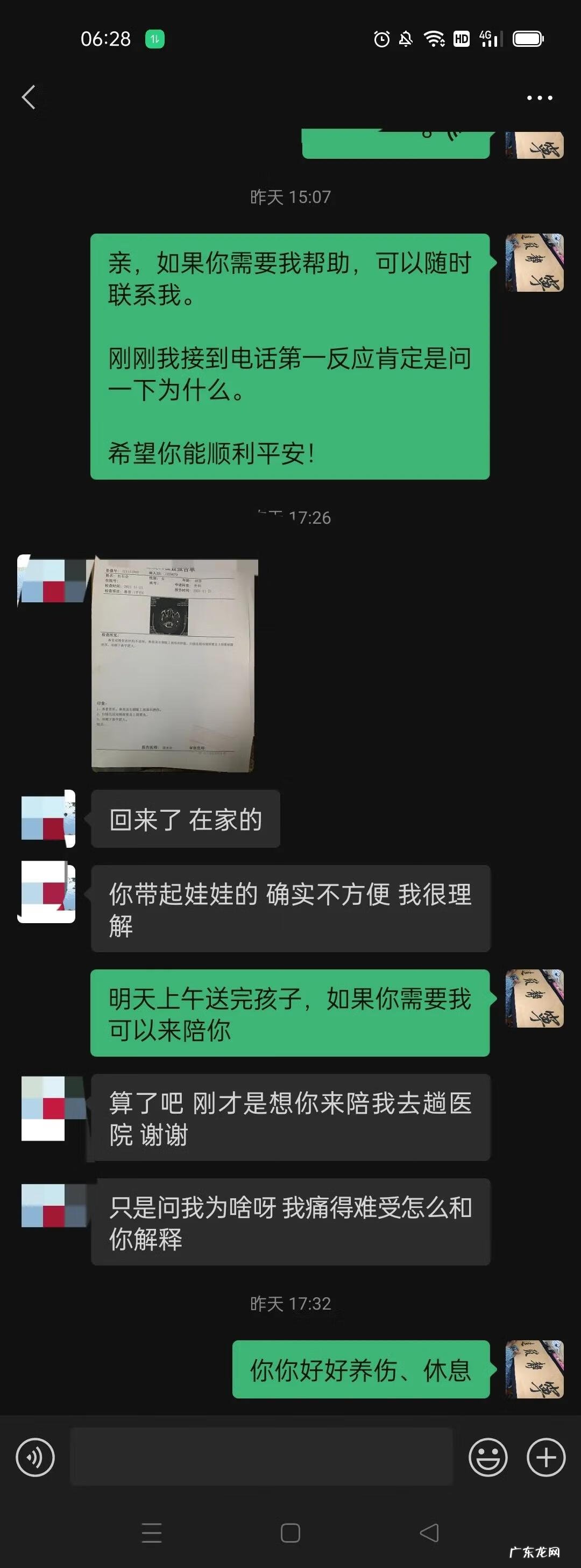 鼻梁骨断了有什么影响 鼻梁骨断掉