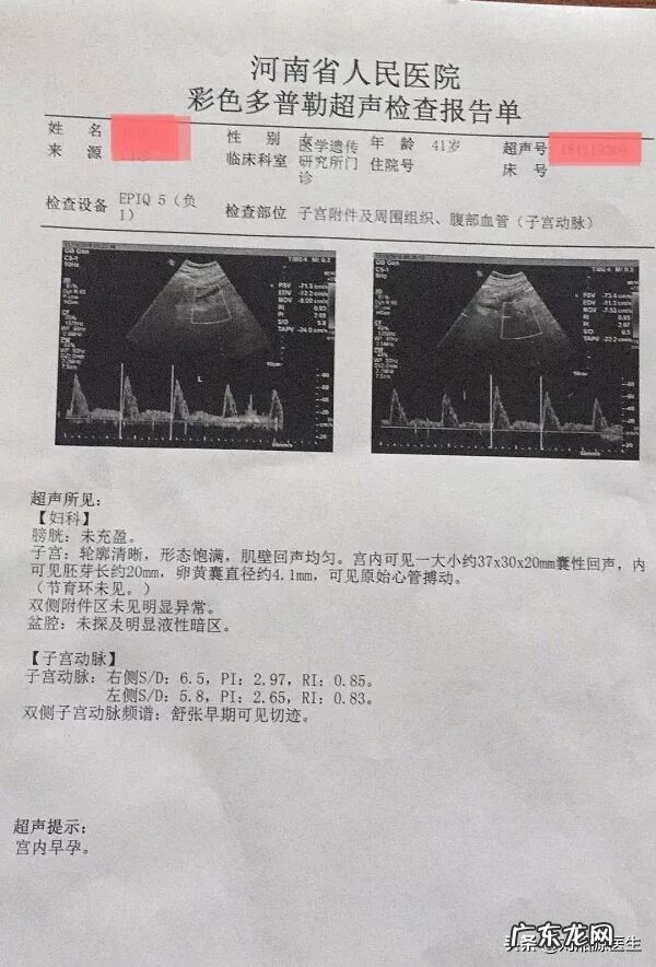 没有胎心跟心情有关系吗 没有胎心跟风水哪个方位有关
