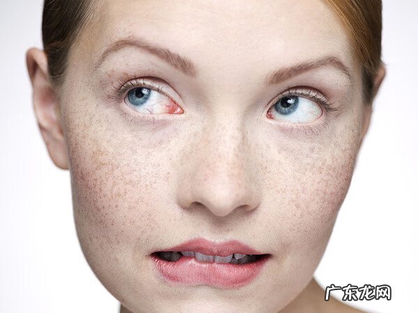 眼部按摩恢复视力按摩手法 自己眼部按摩的正确手法