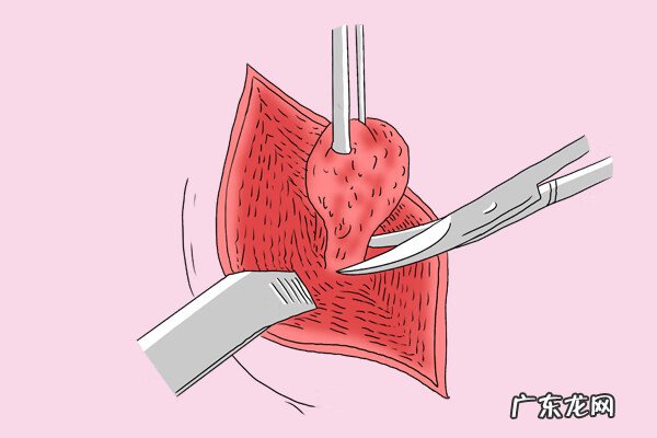 囊肿严重吗男性 囊肿严重吗?