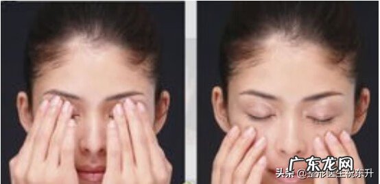 5个去脸部皱纹的方法 脸部去皱纹操