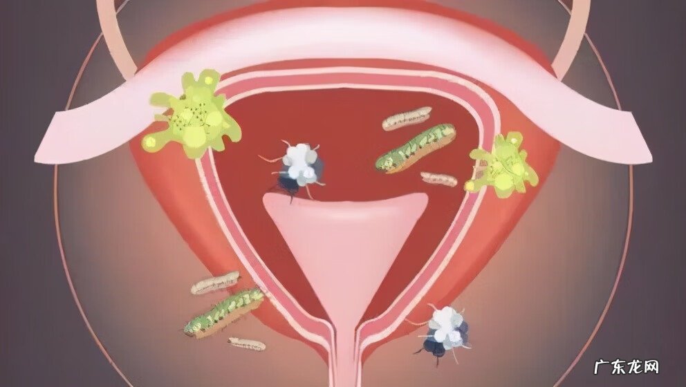 细菌性阴病很严重么 病毒性妇科炎症严重吗
