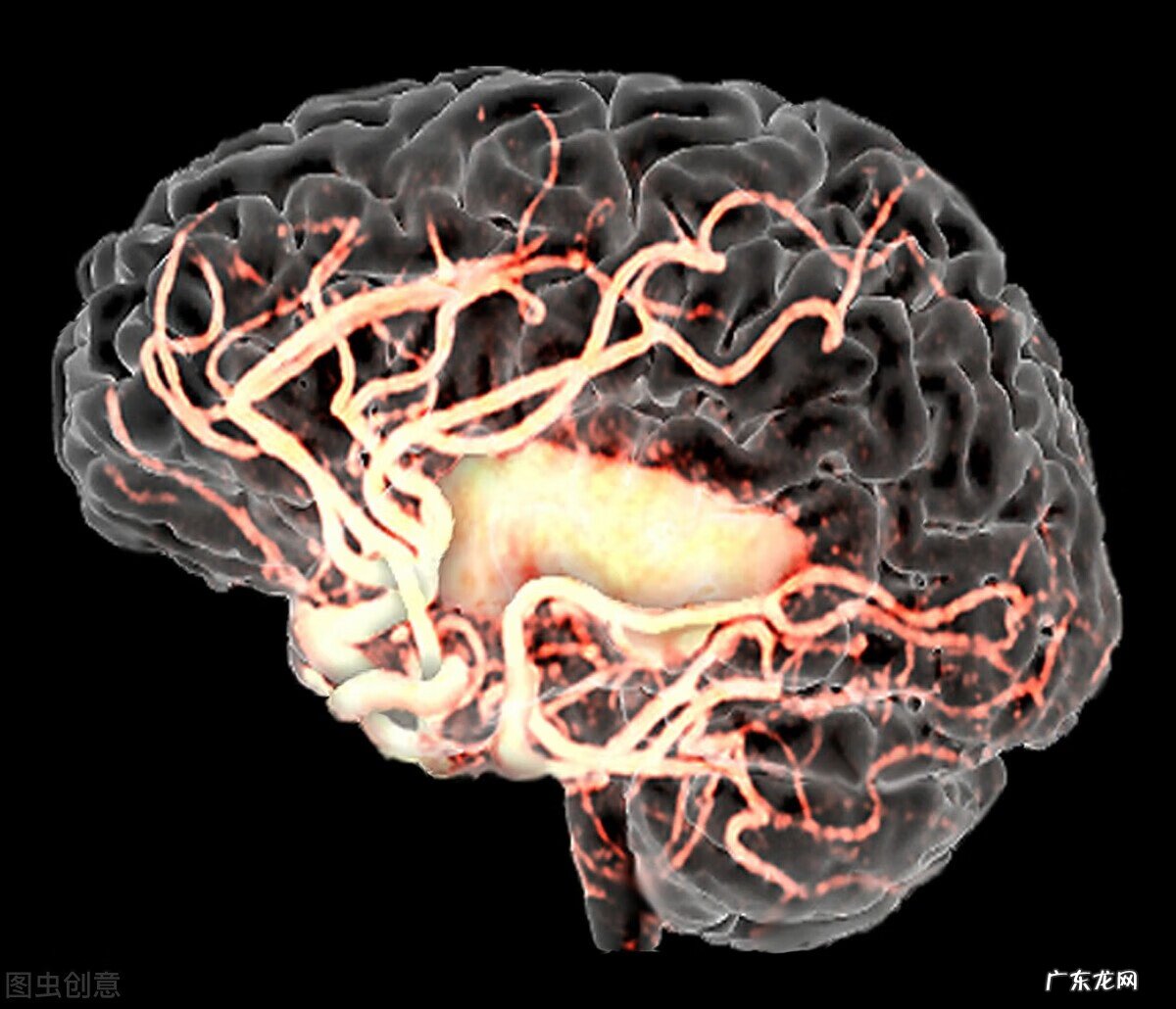 脑中风是什么意思 何谓脑中风