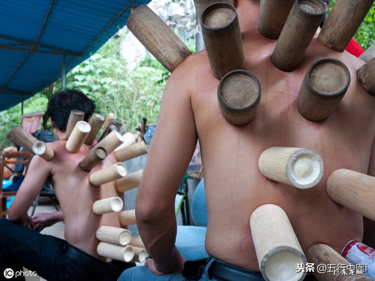 火罐疗法属于什么疗法 火罐疗法的操作步骤