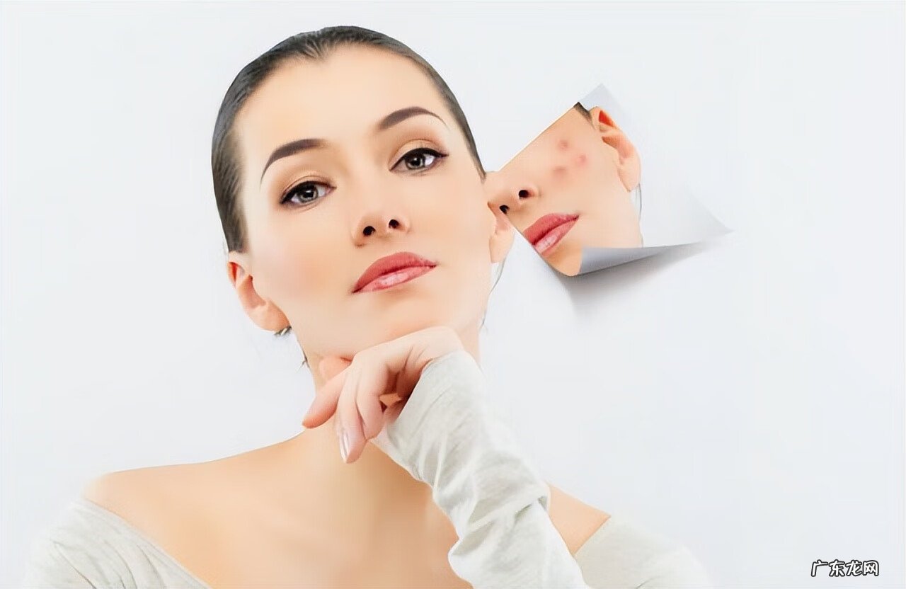 脸上留痘印了怎么能去掉 怎样去脸上的痘印