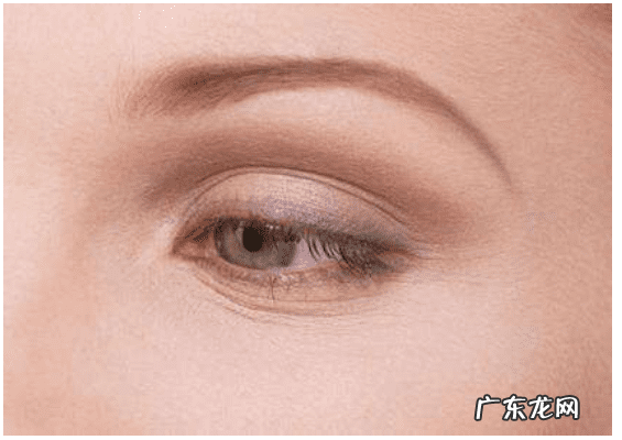 眼部皱纹怎么样才能去掉 如何消除眼部皱纹