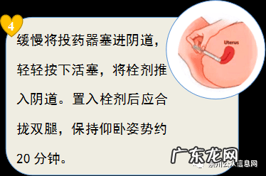 妇科上的栓剂有哪些 妇科栓剂