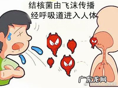 结核病有什么类型 结核病症状表现有哪些