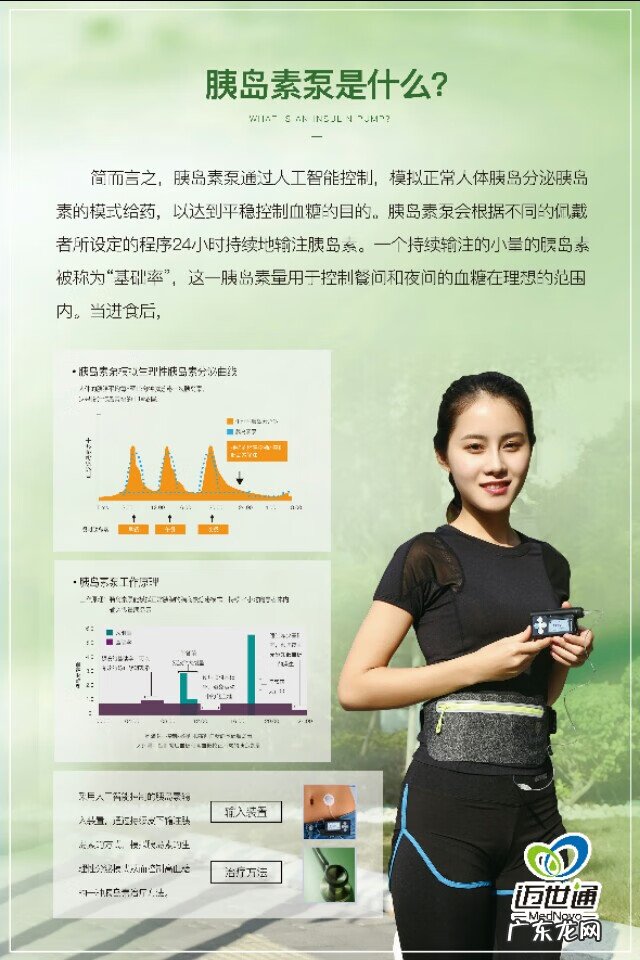 胰岛素泵的危害 胰岛素泵是什么东西