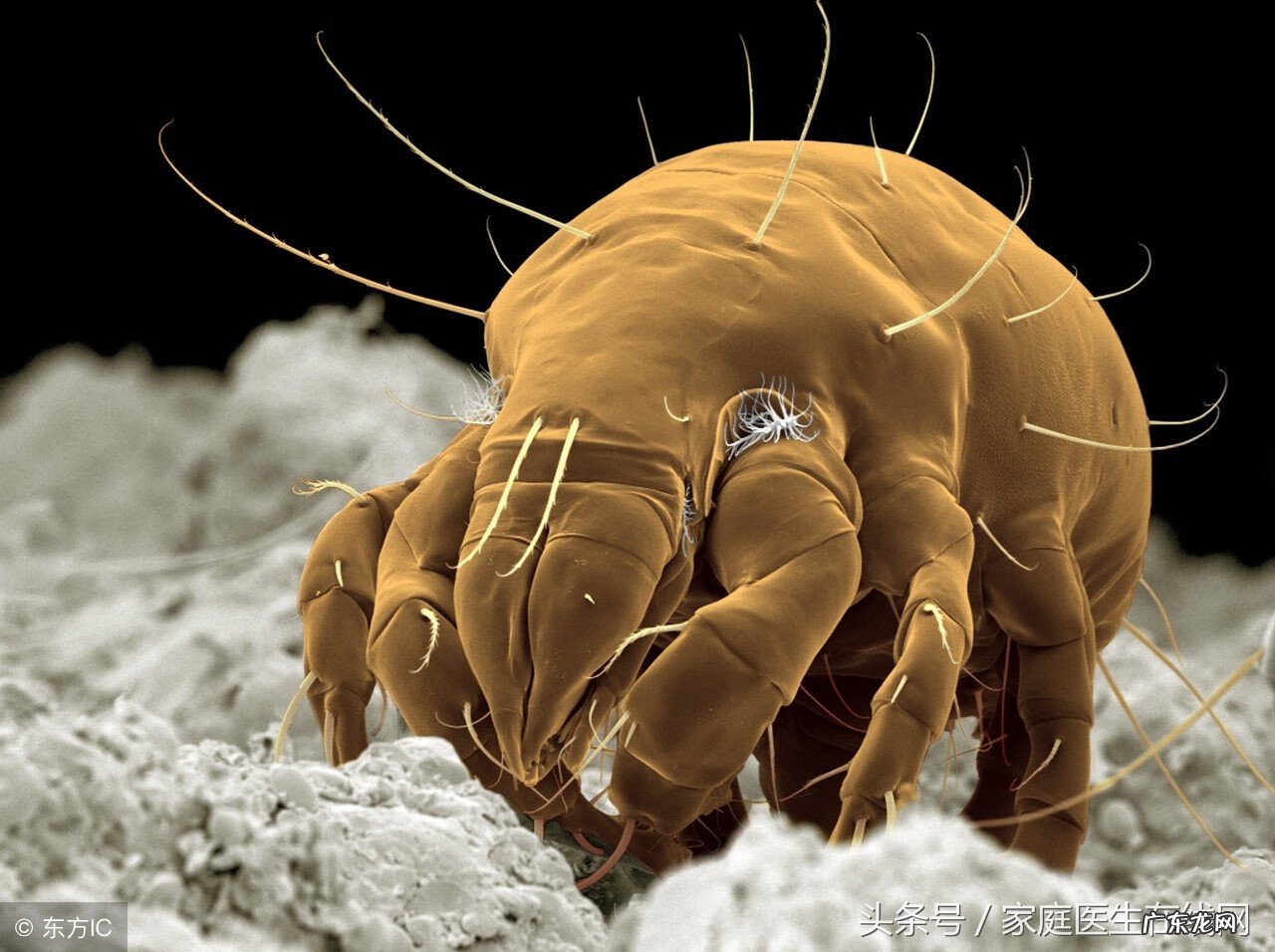 如何治疗螨虫 皮肤螨虫治疗