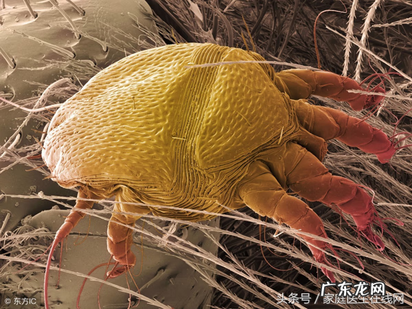 如何治疗螨虫 皮肤螨虫治疗