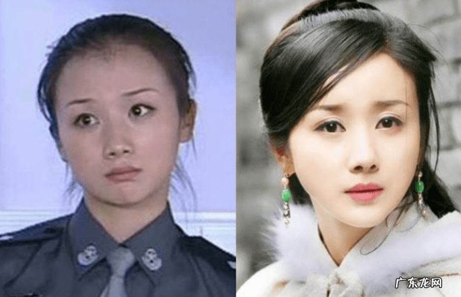 整形上瘾的女明星 整形过的明星