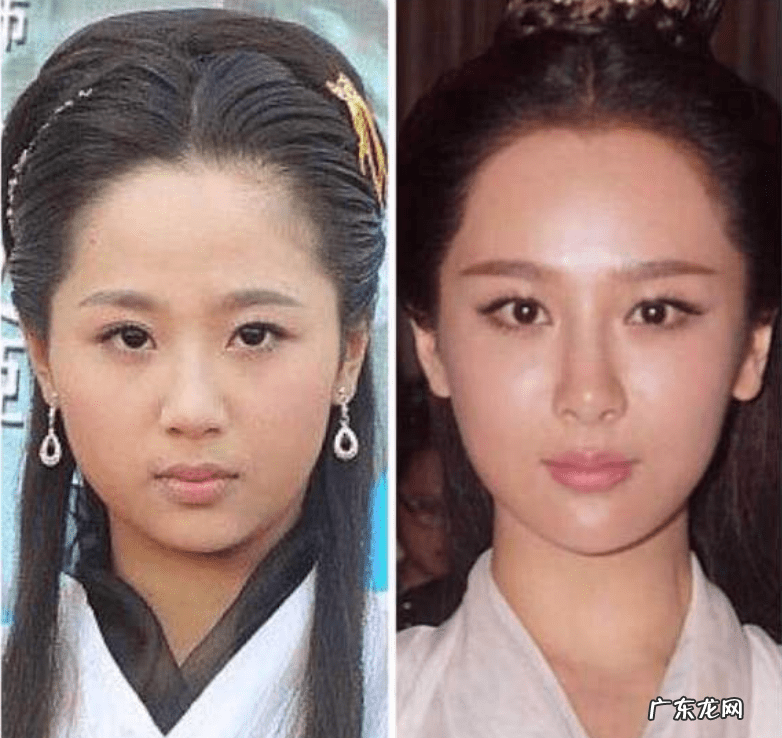 整形上瘾的女明星 整形过的明星